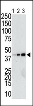 GST Tag Antibody