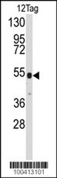 V5 Tag Antibody