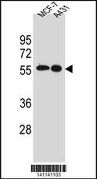 SRC Antibody (N-term)