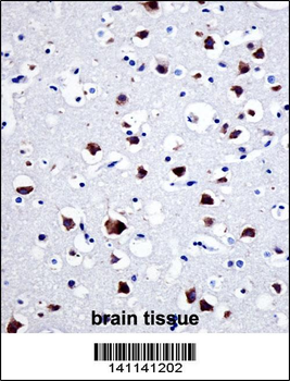 SRC Antibody (N-term)