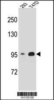 CTNNB1 Antibody (N-term)