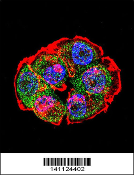 CTNNB1 Antibody (C-term)