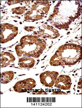 CTNNB1 Antibody (C-term)