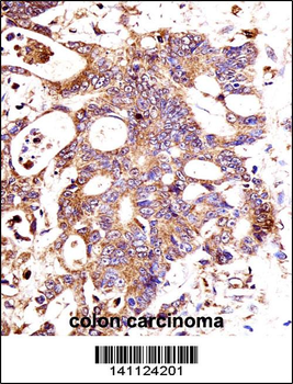 CTNNB1 Antibody (C-term)