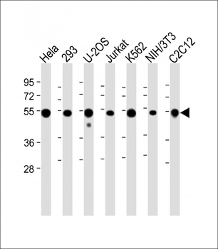 Vimentin Antibody