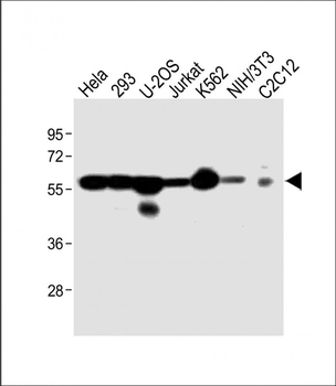 Vimentin Antibody