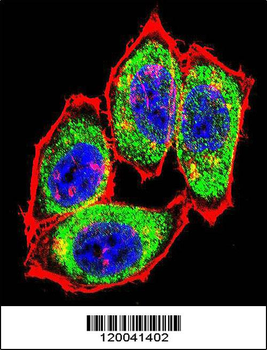 TYSY Antibody(C-term)
