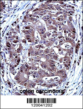 TYSY Antibody(C-term)