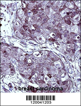 TYSY Antibody(C-term)