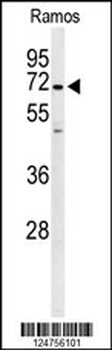 PHTNS Antibody (N-term)