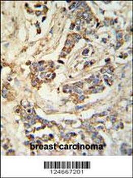 MRAP Antibody (N-term)