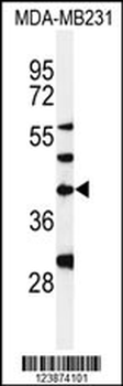 DPAGT1 Antibody (Center)