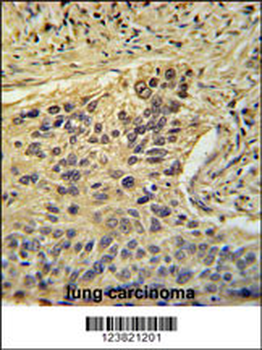 TAF2 Antibody (C-Term)