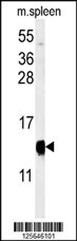 YPEL5 Antibody (C-term)