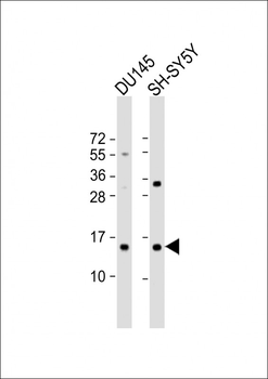 YPEL5 Antibody (C-term)