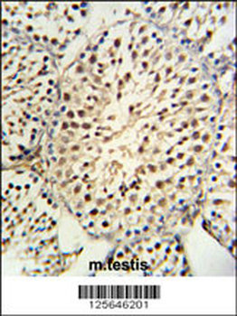 YPEL5 Antibody (C-term)