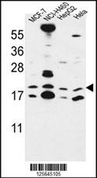 CNPY2 Antibody (C-term)