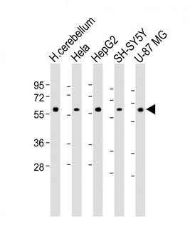 AMH Antibody (Center)