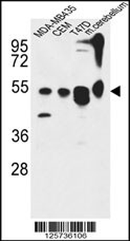 ATG13 Antibody (N-term)