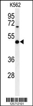 B3GAT1 Antibody (N-term)