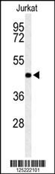 RPR1B Antibody (C-term)