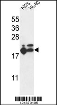 RPL17 Antibody (C-term)