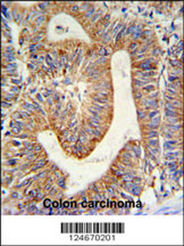 RPL17 Antibody (C-term)