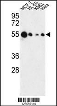 AIM2 Antibody (N-term)