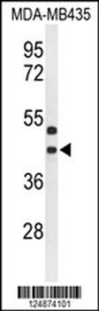 GPR17 Antibody (Center)
