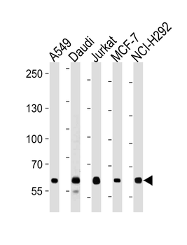 FOXP1 Antibody (C-term)