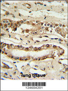 FOXP1 Antibody (C-term)