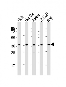 DFFB Antibody (N-term)