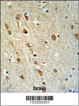 ZRANB1 Antibody (C-term)