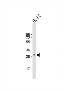 HLA-DRB5 Antibody (Center)