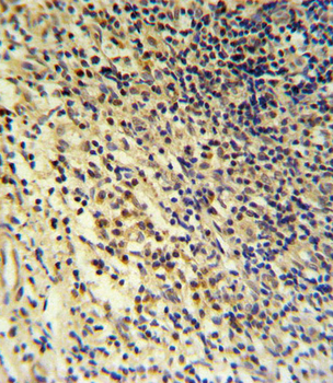 PLA2G7 Antibody (Center)