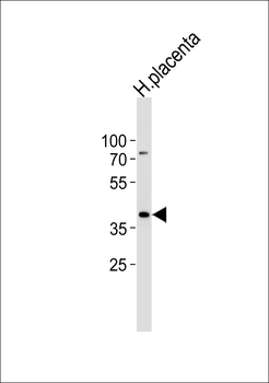 IDH3G Antibody (C-term)