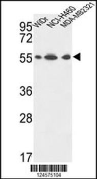 ATP5A1 Antibody (C-term)