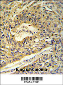 ATP5A1 Antibody (C-term)