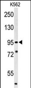 SUPV3L1 Antibody (N-term)