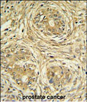 SUPV3L1 Antibody (N-term)