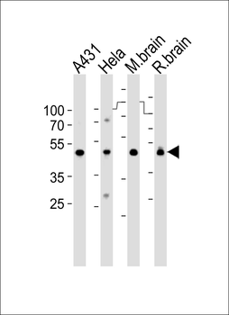 NDUFS2 Antibody (Center)