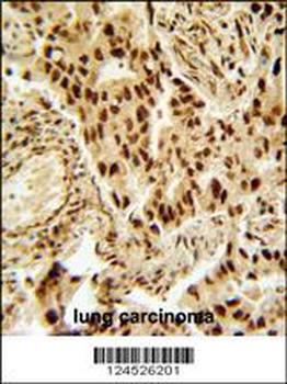 HDAC2 Antibody (Center)