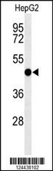 SGMS2 Antibody (C-term)