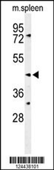 SGMS2 Antibody (C-term)
