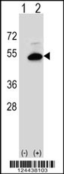 SGMS2 Antibody (C-term)