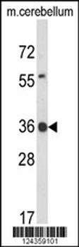 CLDND1 Antibody (Center)