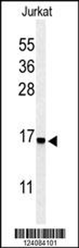 RPS25 Antibody (N-term)