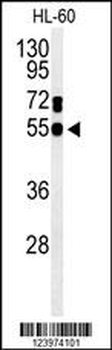 GDA Antibody (N-term)
