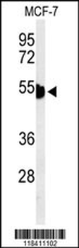 KRT1 Antibody (Center)