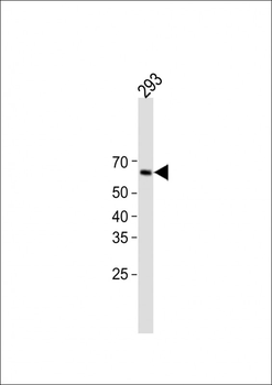 KRT1 Antibody (Center)